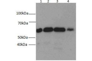 Western blot analysis of (1) HEK-293, (2) MDA-MB-453s, (3) NIH/3T3, and (4) SH-SY5Y cell lysates subjected to SDS-PAGE, using Beclin 1 antibody at a dilution of 1:1500. (Beclin 1 Antikörper)