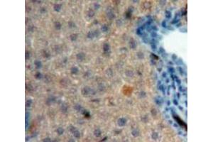 Used in DAB staining on fromalin fixed paraffin-embedded Liver tissue (CRH Antikörper  (AA 40-195))