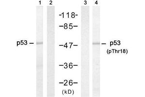 Western blot analysis of extracts from HT-29 cells untreated or treated with hydroxyurea, using p53 (Ab-18) antibody (E021086, Lane 1 and 2) and p53 (phospho-Thr18) antibody (E011095, Lane 3 and 4). (p53 Antikörper  (pThr18))