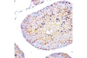 Immunohistochemistry of paraffin-embedded mouse testis using Integrin alpha 4 (ITG/CD49d) (ITG/CD49d) Rabbit mAb (054) at dilution of 1:100 (40x lens). (ITGA4 Antikörper)