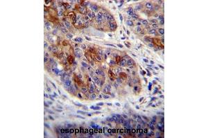 Immunohistochemistry (IHC) image for anti-HCLS1 Associated Protein X-1 (HAX1) antibody (ABIN2996652) (HAX1 Antikörper)