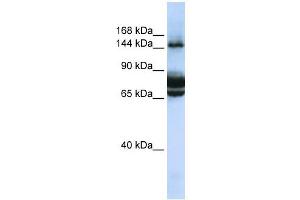 FAM83B antibody used at 1 ug/ml to detect target protein. (FAM83B Antikörper  (C-Term))