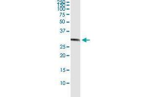 Immunoprecipitation of CCS transfected lysate using rabbit polyclonal anti-CCS and Protein A Magnetic Bead (CCS (Human) IP-WB Antibody Pair)