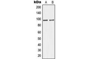Western blot analysis of GIT1 expression in HuvEc (A), HeLa (B) whole cell lysates. (GIT1 Antikörper  (C-Term))