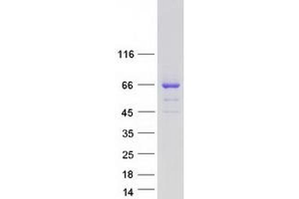 TKTL2 Protein (Myc-DYKDDDDK Tag)