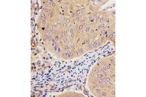 Immunohistochemistry (Paraffin-embedded Sections) (IHC (p)) image for anti-Glutamate-Cysteine Ligase, Modifier Subunit (GCLM) (AA 246-274), (C-Term) antibody (ABIN653046)