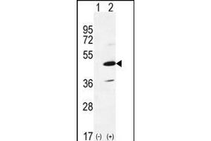 Western blot analysis of IRAK4 (arrow) using rabbit polyclonal IRAK4 Antibody (R20) (ABIN6243238 and ABIN6579012). (IRAK4 Antikörper  (N-Term))