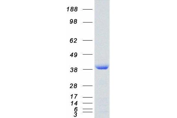 SET/TAF-I Protein (Transcript Variant 2) (Myc-DYKDDDDK Tag)