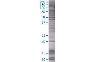 BCL2L10 transfected lysate. (BCL2L10 293T Cell Transient Overexpression Lysate(Denatured))