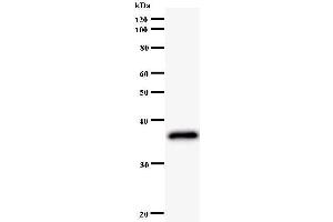 Western Blotting (WB) image for anti-LIM Homeobox 2 (LHX2) antibody (ABIN930948) (LHX2 Antikörper)