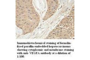 Image no. 1 for anti-Vascular Endothelial Growth Factor A (VEGFA) antibody (ABIN791193) (VEGFA Antikörper)