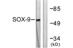 Western blot analysis of extracts from 293 cells, treated with PBS 60', using SOX9 (Ab-181) Antibody. (SOX9 Antikörper  (AA 147-196))