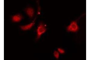 ABIN6276317 staining  HeLa cells by IF/ICC. (HSP27 Antikörper  (N-Term))