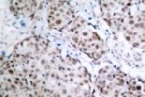 Image no. 2 for anti-Tumor Protein P53 (TP53) (pSer315) antibody (ABIN318092) (p53 Antikörper  (pSer315))