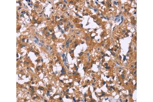 Immunohistochemistry (IHC) image for anti-G Protein-Coupled Receptor 172B (GPR172B) antibody (ABIN2433107) (GPR172B Antikörper)