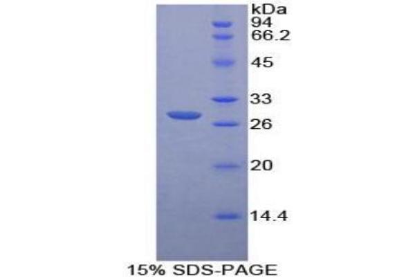 PTPRM Protein