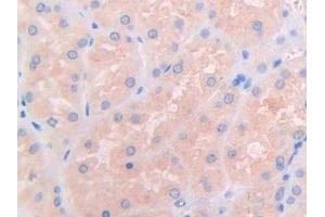 IHC-P analysis of Human Kidney Tissue, with DAB staining. (IL3RA Antikörper  (AA 19-157))