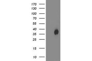 Western Blotting (WB) image for anti-Haloacid Dehalogenase-Like Hydrolase Domain Containing 2 (HDHD2) antibody (ABIN1498629) (HDHD2 Antikörper)