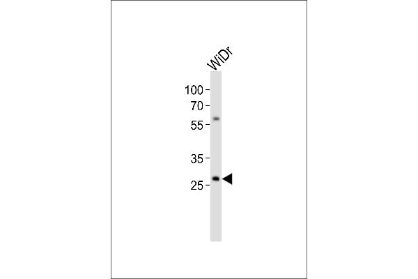 COX11 Antikörper  (C-Term)