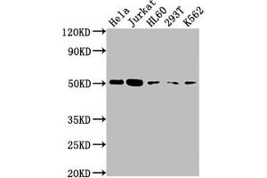 Western Blot Positive WB detected in: Hela whole cell lysate, Jurkat whole cell lysate, HL60 whole cell lysate, 293T whole cell lysate, K562 whole cell lysate All lanes: CASP2 antibody at 1:2000 Secondary Goat polyclonal to rabbit IgG at 1/50000 dilution Predicted band size: 51, 35, 11 kDa Observed band size: 51 kDa (Rekombinanter Caspase 2 Antikörper)