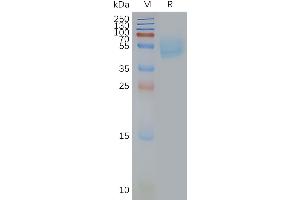 Human ADA-Nanodisc, Flag Tag on SDS-PAGE (Adenosine A2a Receptor Protein (ADORA2A))