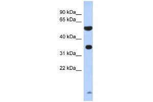 ESSPL antibody used at 1 ug/ml to detect target protein. (ESSPL Antikörper  (N-Term))