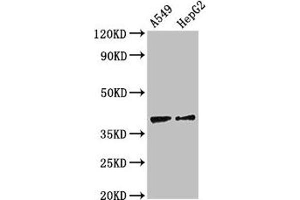 CCR1 Antikörper  (AA 314-362)