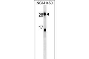 CRP Antibody (ABIN1539893 and ABIN2843851) western blot analysis in NCI- cell line lysates (35 μg/lane). (CRP Antikörper  (AA 8-35))
