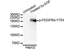 Western blot analysis of extracts of HepG2 cell line, using Phospho-PDGFRA-Y754 antibody. (PDGFRA Antikörper  (pTyr754))