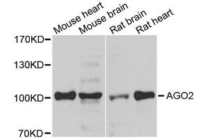 Western blot analysis of extracts of various cell lines, using AGO2 antibody (ABIN1877052) at 1:1000 dilution. (AGO2 Antikörper)