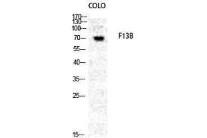Western Blotting (WB) image for anti-Coagulation Factor 13, B Polypeptide (F13B) (N-Term) antibody (ABIN3175044) (F13B Antikörper  (N-Term))