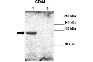 Lanes : Lane 1: 10ug MDA-MB-231 lysateLane 2: MDA-MB-231 + CD44 siRNA  Primary Antibody Dilution :  1:1000   Secondary Antibody : Goat anti rabbit-HRP  Secondary Antibody Dilution :  1:10,000  Gene Name : CD44  Submitted by : Chul Geun Kim and Dae Hyun Ha, Hanyang University. (CD44 Antikörper  (C-Term))