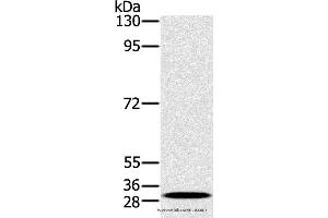Western blot analysis of K562 cell, using RAB27A Polyclonal Antibody at dilution of 1:400 (RAB27A Antikörper)