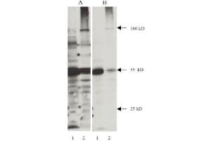 Western Blotting (WB) image for anti-Nitrotyrosine antibody (ABIN264465) (Nitrotyrosine Antikörper)