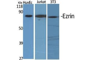 Western Blot (WB) analysis of specific cells using Ezrin Polyclonal Antibody. (Ezrin Antikörper  (C-Term))