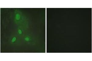 Immunofluorescence (IF) image for anti-BTB and CNC Homology 1, Basic Leucine Zipper Transcription Factor 1 (BACH1) (AA 131-180) antibody (ABIN2889311) (BACH1 Antikörper  (AA 131-180))