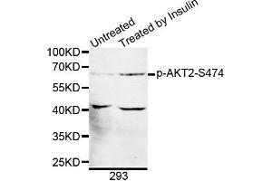 Western blot analysis of extracts of 293 cell line, using phospho-AKT2-S474 antibody. (AKT2 Antikörper  (pSer474))