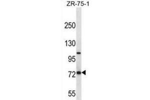 Western Blotting (WB) image for anti-Folate Hydrolase (Prostate-Specific Membrane Antigen) 1 (FOLH1) antibody (ABIN2997484) (PSMA Antikörper)