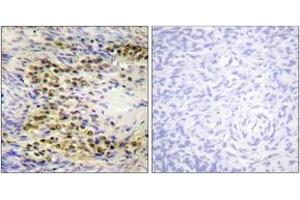 Immunohistochemistry analysis of paraffin-embedded human ovary, using Akt (Phospho-Thr72) Antibody. (AKT1 Antikörper  (pThr72))