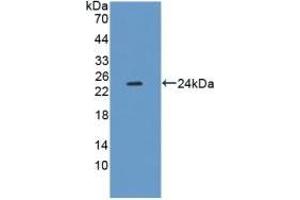 Detection of Recombinant XDH, Mouse using Polyclonal Antibody to Xanthine Dehydrogenase (XDH) (XDH Antikörper  (AA 231-416))