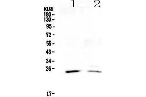 Western blot analysis of StAR using anti-StAR antibody . (STAR Antikörper)