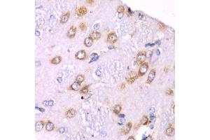 Immunohistochemistry of paraffin-embedded rat brain using RPS3A Antibody. (RPS3A Antikörper)