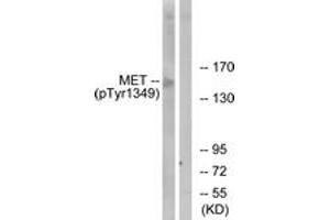 Western blot analysis of extracts from HepG2 cells, using Met (Phospho-Tyr1349) Antibody. (c-MET Antikörper  (pTyr1349))