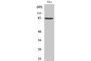 Western Blotting (WB) image for anti-Ankyrin Repeat and Protein Kinase Domain-Containing Protein 1 (ANKK1) (Internal Region) antibody (ABIN3180874) (ANKK1 Antikörper  (Internal Region))