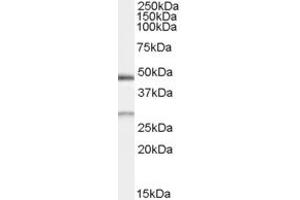 Western Blotting (WB) image for anti-BCL2/adenovirus E1B 19kDa Interacting Protein 1 (BNIP1) antibody (ABIN5858878) (BNIP1 Antikörper)