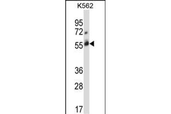 CBLC Antikörper  (C-Term)