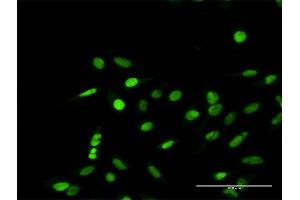 Immunofluorescence of purified MaxPab antibody to RPA1 on HeLa cell. (RPA1 Antikörper  (AA 1-616))