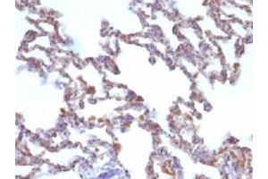 Immunohistochemistry (IHC) image for anti-Moesin (MSN) antibody (ABIN4949796)