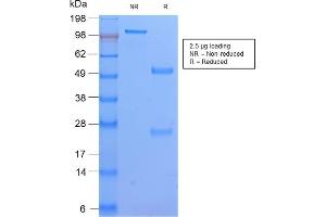 SDS-PAGE Analysis Purified HLA-DP Rabbit Recombinant Monoclonal Ab (HLA-DPB1/2862R). (Rekombinanter HLA-DPB1 Antikörper)