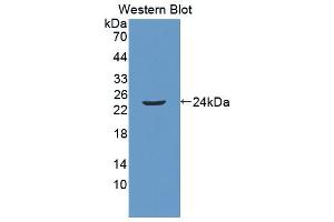 Western blot analysis of the recombinant protein. (Anoctamin 2 Antikörper  (AA 823-1003))